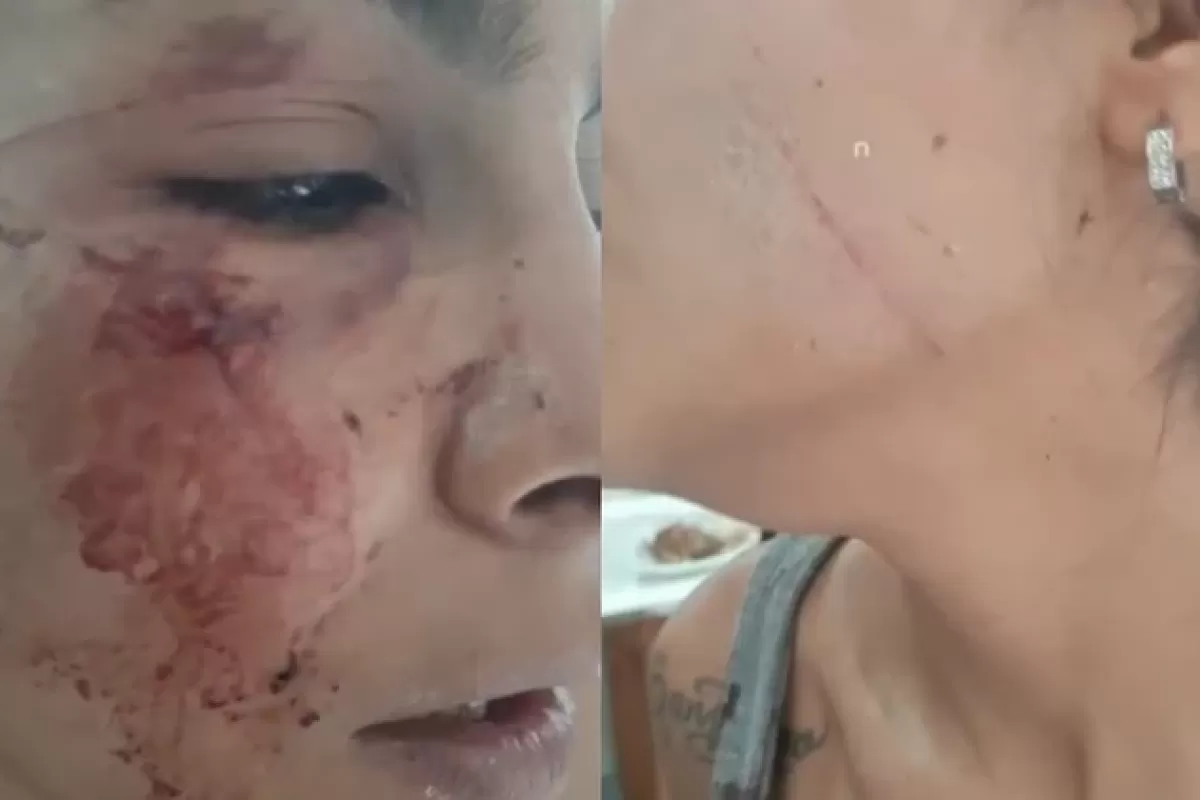 VIDEO | Mar del Plata: citaron a una joven con un enga&ntilde;o y la atacaron con un cuchillo en un descampado