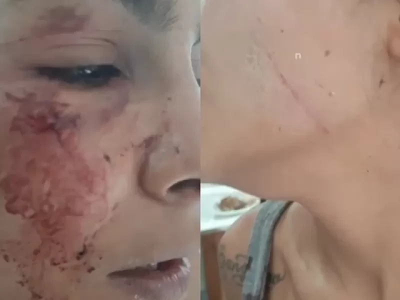 VIDEO | Mar del Plata: citaron a una joven con un enga&ntilde;o y la atacaron con un cuchillo en un descampado