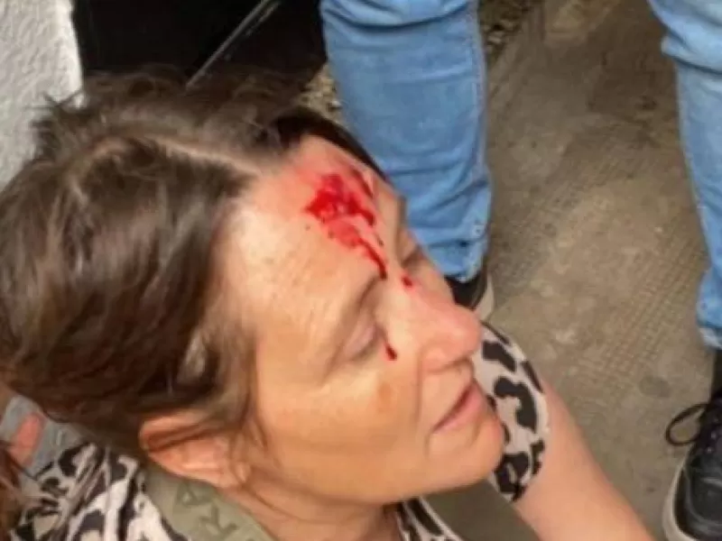 Violenta irrupción en el Normal 2 de La Plata dejó heridos y pánico entre estudiantes